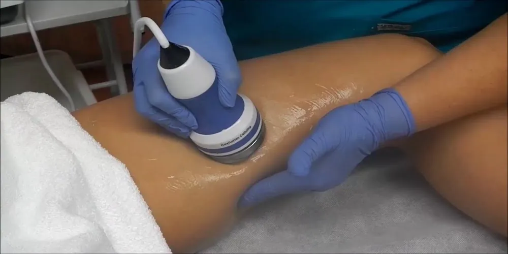 Cavitation Newcastle Leg