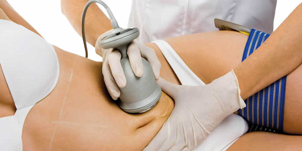 What Is Ultrasonic Cavitation - RT Aesthetics | Newcastle | Fat Reduction