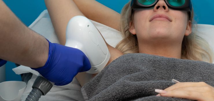 Laser Hair Removal Newcastle