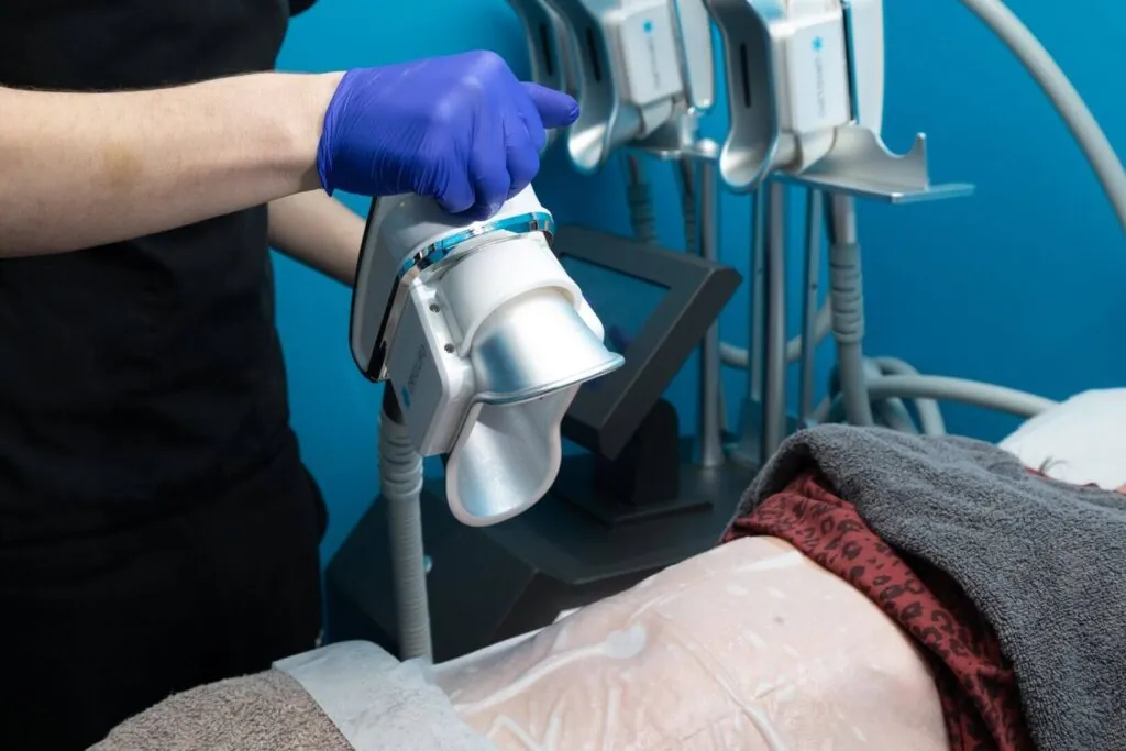 Fat Freezing Treatment Procedure