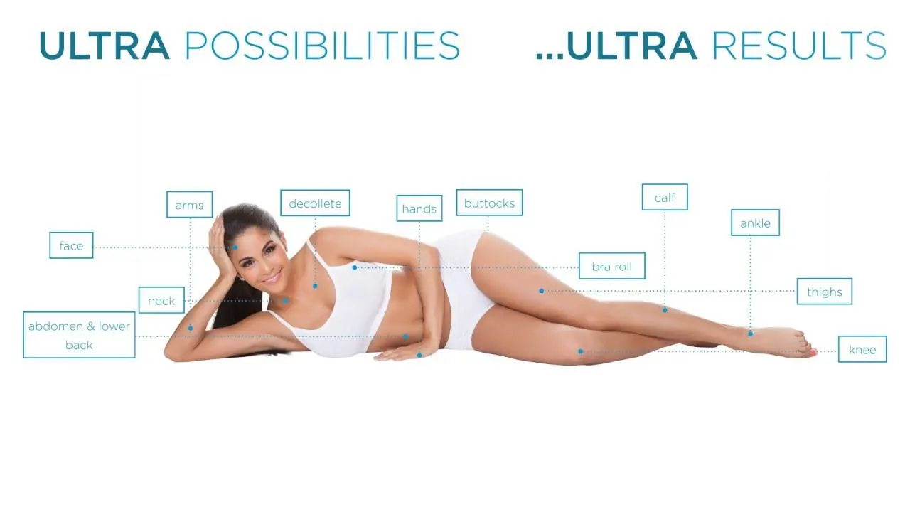 New Exilis Elite Treatment