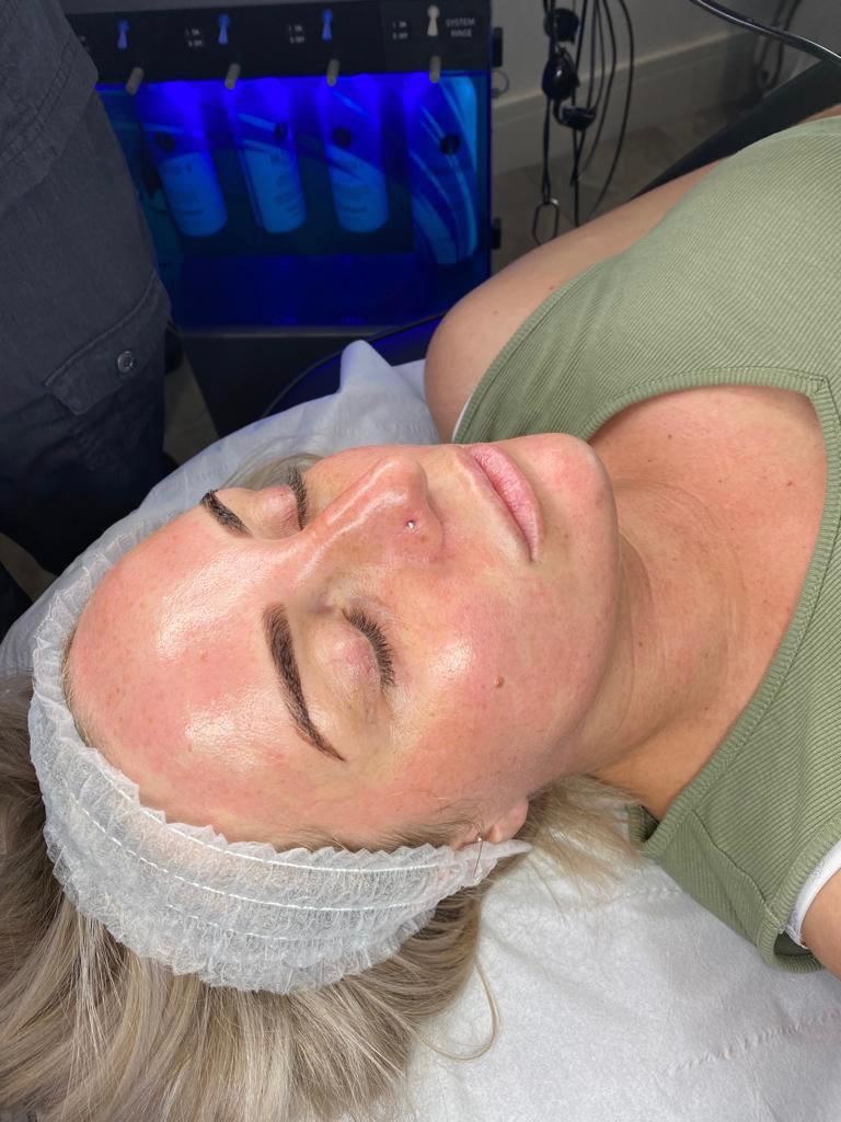 RTOrganics Facial