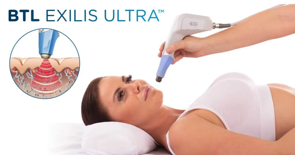 BTL Exilis Ultra Face in Newcastle