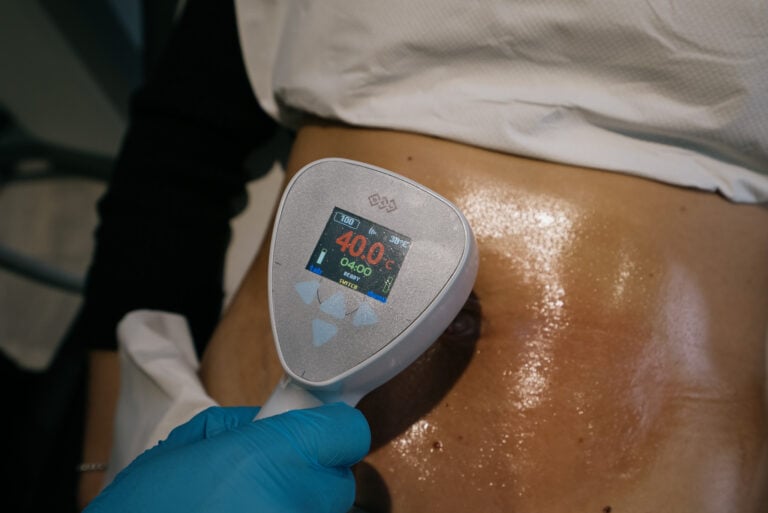 3D Lipo in Newcastle: What It Is, Does It Work, and What We Use Instead