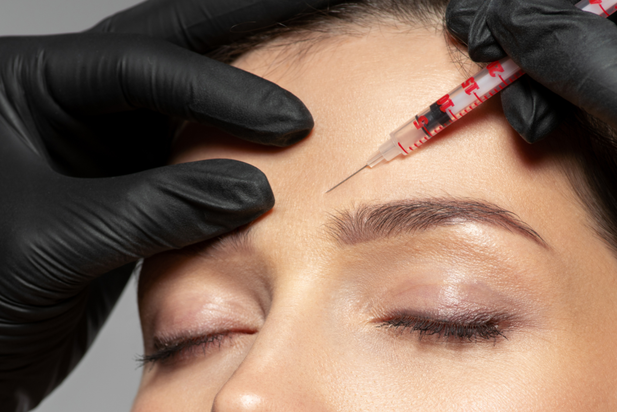 Anti-Wrinkle Injections