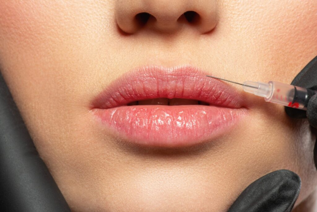 Dermal Fillers Newcastle